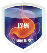 gastric cancer